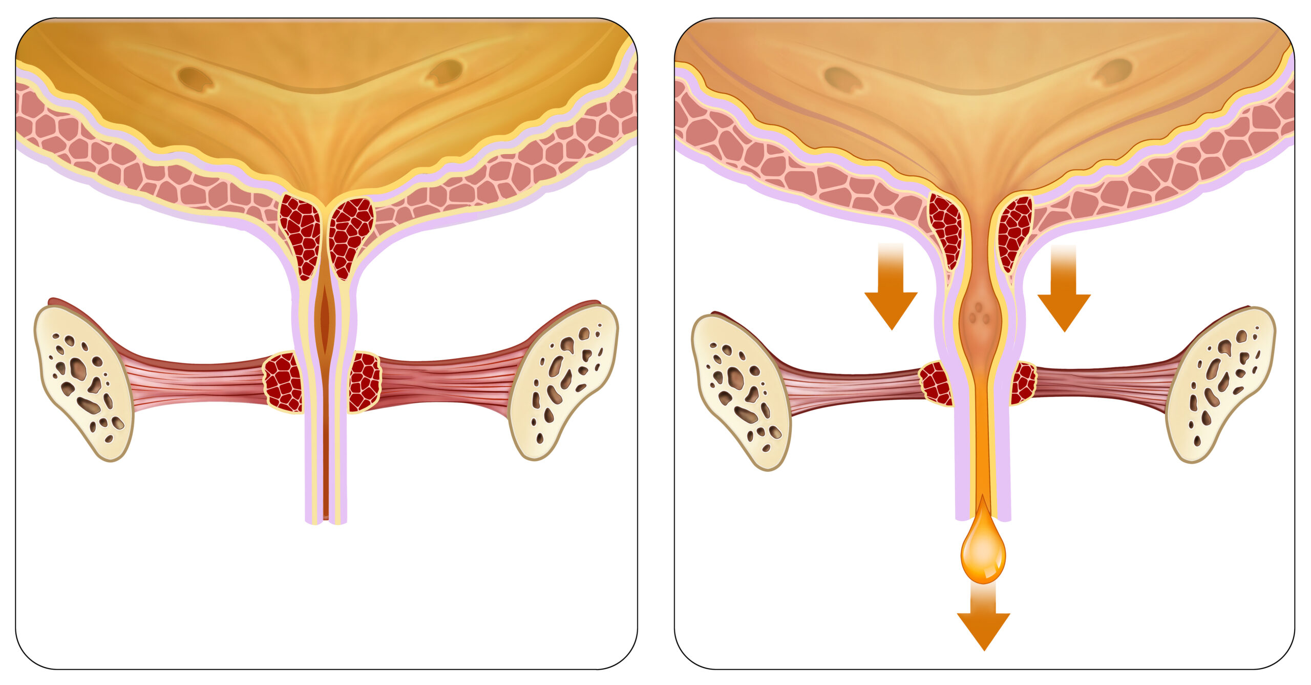 Descriptive,Illustration,Of,The,Part,Of,The,Bladder,Where,Urinary